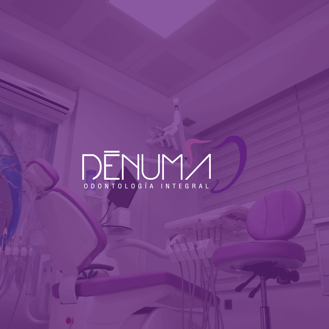 DENUMA